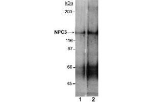 Western blot analysis of Npc1l1 in rat small intestine membrane preparations (Lane 1 : 2 ug/mL , Lane 2 : 4 ug/mL) with Npc1l1 polyclonal antibody . (NPC1L1 抗体  (AA 1000-1100))