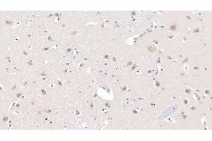 Detection of APOL2 in Human Cerebrum Tissue using Monoclonal Antibody to Apolipoprotein L2 (APOL2) (Apolipoprotein L 2 抗体  (AA 186-337))