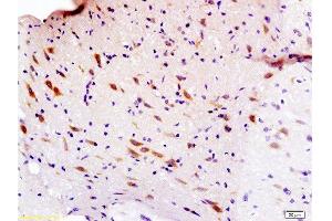 Immunohistochemistry (Paraffin-embedded Sections) (IHC (p)) image for anti-Sema Domain, Immunoglobulin Domain (Ig), Short Basic Domain, Secreted, (Semaphorin) 3F (SEMA3F) (AA 651-754) antibody (ABIN737976)