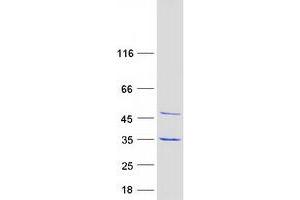 Eukaryotic Translation Elongation Factor 1 beta 2 (EEF1B2) (Transcript Variant 3) protein (Myc-DYKDDDDK Tag)