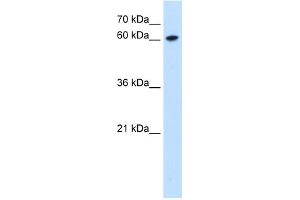 WB Suggested Anti-ZNF169 Antibody Titration:  0. (ZNF169 抗体  (Middle Region))