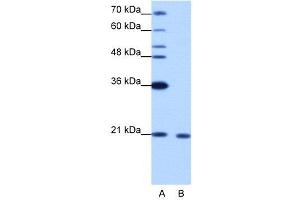 WB Suggested Anti-RBM8A  Antibody Titration: 1. (RBM8A 抗体  (N-Term))
