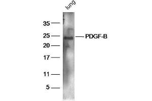 Mouse lung lysates probed with Rabbit Anti-PDGF-B Polyclonal Antibody, Unconjugated  at 1:5000 for 90 min at 37˚C. (PDGFB 抗体  (AA 155-210))