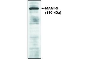 Western blot analysis using MAGI-3, GKWW antibody on cell lysates transfected with full-length human MAGI-3 protein. (SH3BP4 抗体)