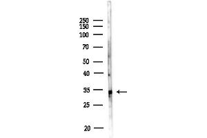anti-Heterogeneous Nuclear Ribonucleoprotein A/B (HNRNPAB) (N-Term) antibody