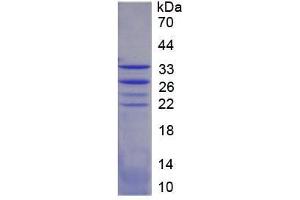 SDS-PAGE analysis of Mouse FOXO1 Protein. (FOXO1 蛋白)