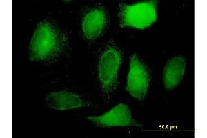 Immunofluorescence of  purified  MaxPab antibody to RRM2 on HeLa cell. (RRM2 抗体  (AA 1-389))
