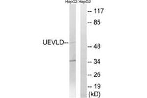 Western blot analysis of extracts from HepG2 cells, using UEVLD Antibody. (UEVLD 抗体  (AA 141-190))