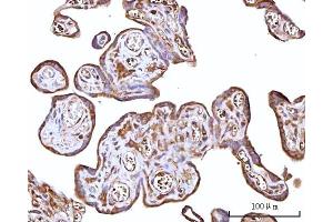 IHC analysis of RPS15A using anti-RPS15A antibody (ABIN7598954).