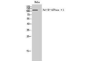 Western Blotting (WB) image for anti-Sodium Potassium ATPase, alpha1 (ATP1A1) (Ser23) antibody (ABIN3185759) (ATP1A1 抗体  (Ser23))