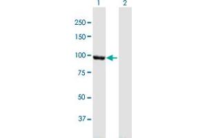 Western Blot analysis of CTNNA2 expression in transfected 293T cell line by CTNNA2 MaxPab polyclonal antibody. (CTNNA2 抗体  (AA 1-905))