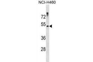 Western Blotting (WB) image for anti-Rh Family C Glycoprotein (RHCG) antibody (ABIN3000734) (RHCG 抗体)