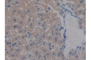 Detection of REG3b in Mouse Liver Tissue using Polyclonal Antibody to Regenerating Islet Derived Protein 3 Beta (REG3b) (REG3B 抗体  (AA 27-175))