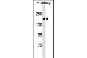 ACE Antibody (Ascites) ABIN1539969 western blot analysis in mouse kidney tissue lysates (35 μg/lane). (Angiotensin I Converting Enzyme 1 抗体  (AA 1274-1306))