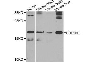 Western blot analysis of extracts of various cell lines, using UBE2NL antibody. (UBE2NL 抗体  (AA 1-100))