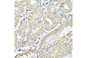 Immunohistochemistry (IHC) image for anti-Spectrin alpha Chain, Brain (SPTAN1) (AA 950-1130) antibody (ABIN6148403)