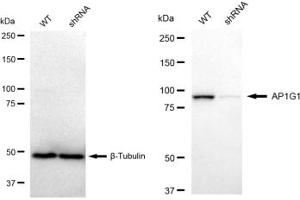 Western blotting analysis using AP1G1 antibody (ABIN7797508). (Recombinant gamma 1 Adaptin 抗体)