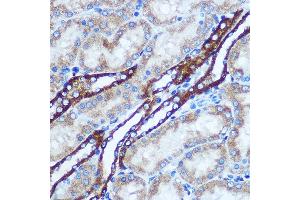 Immunohistochemistry (IHC) image for anti-Glutathione S-Transferase theta 1 (GSTT1) (AA 1-240) antibody (ABIN3021871)