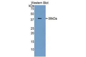 Western Blotting (WB) image for anti-Lectin, Galactoside-Binding, Soluble, 8 (LGALS8) (AA 1-317) antibody (ABIN1078059) (LGALS8 抗体  (AA 1-317))