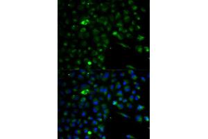 Immunofluorescence analysis of A549 cell using ALDH1A1 antibody. (ALDH1A1 抗体  (AA 48-147))