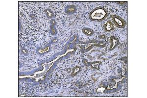 IHC analysis of CLPP using anti-CLPP antibody (ABIN5693176).