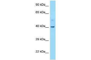 WB Suggested Anti-CNR2 Antibody Titration: 1. (CNR2 抗体  (C-Term))