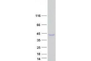 Western Blotting (WB) image for Nascent Polypeptide Associated Complex alpha 1 (NACa1) (Transcript Variant 4) protein (Myc-DYKDDDDK Tag) (ABIN2726773)