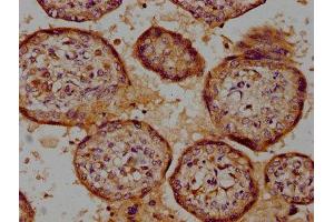 IHC image of ABIN7174015 diluted at 1:100 and staining in paraffin-embedded human placenta tissue performed on a Leica BondTM system. (CSK 抗体  (AA 325-416))