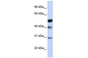 Image no. 1 for anti-Transcription Factor AP-2 beta (Activating Enhancer Binding Protein 2 Beta) (TFAP2B) (AA 35-84) antibody (ABIN6742379) (TFAP2B 抗体  (AA 35-84))
