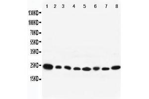 Western Blotting (WB) image for anti-RAB8A, Member RAS Oncogene Family (RAB8A) (AA 170-183), (C-Term) antibody (ABIN3042554) (RAB8A 抗体  (C-Term))