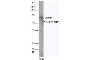 Human A549 cell lysates probed with Rabbit Anti-ACVR2B/ACTR-IIB Polyclonal Antibody, Unconjugated  at 1:5000 for 90 min at 37˚C. (ACVR2B 抗体  (AA 45-150))