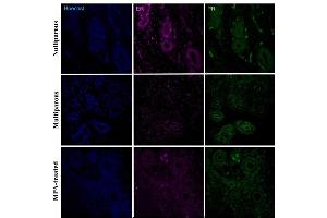 Immunohistochemical detection of progesterone receptor (PR) and estradiol receptor (ER-a) in the basal region of the endometrium in uteri of nulliparous, multiparous and MPA-treated dogs. (Estrogen Receptor alpha 抗体  (pTyr537) (Alexa Fluor 647))