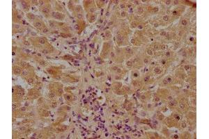 IHC image of ABIN7146046 diluted at 1:100 and staining in paraffin-embedded human liver tissue performed on a Leica BondTM system. (CLEC1A 抗体  (AA 66-316))