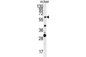 ZCCHC5 Antibody (N-term) western blot analysis in mouse liver tissue lysates (15 µg/lane). (ZCCHC5 抗体  (N-Term))