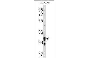 Western blot analysis in Jurkat cell line lysates (35ug/lane). (ACER1 抗体  (C-Term))