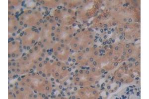 DAB staining on IHC-P; Samples: Mouse Kidney Tissue (EIF2AK2 抗体  (AA 205-495))