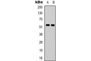 Western blot analysis of GPR37L1 expression in A549 (A), Hela (B) whole cell lysates. (GPR37L1 抗体  (N-Term))