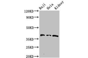 Western Blot Positive WB detected in: Raji whole cell lysate, Hela whole cell lysate, Mouse kidney tissue All lanes: RFC4 antibody at 2. (RFC4 抗体  (AA 9-142))