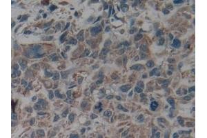 Immunohistochemistry (IHC) image for anti-Keratin 9 (KRT9) (AA 315-456) antibody (ABIN7431980)