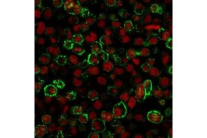 Analysis of Protein Array containing more than 19,000 full-length human proteins using CD20 Monospecific Recombinant Mouse Monoclonal Antibody (rIGEL/773). (Recombinant CD20 抗体)