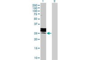 Western Blot analysis of FOLR3 expression in transfected 293T cell line by FOLR3 MaxPab polyclonal antibody. (FOLR3 抗体  (AA 1-245))
