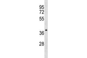 NDRG4 antibody western blot analysis in CEM lysate. (NDRG4 抗体  (AA 193-220))
