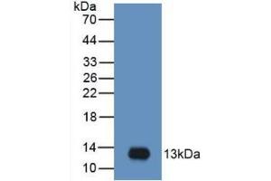Western blot analysis of recombinant Human MIP3a. (CCL20 抗体  (AA 27-96))
