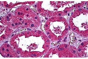 Human Kidney: Formalin-Fixed, Paraffin-Embedded (FFPE) (ERBB3 抗体  (AA 21-332))