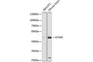 Western blot analysis of extracts of various cell lines using KCNJ6 Polyclonal Antibody at dilution of 1:1000. (KCNJ6 抗体)