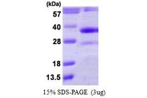 Dehydrogenase/reductase (SDR Family) Member 4 (DHRS4) (AA 1-278) protein (His tag)