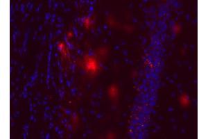 Immunostaining of a PFA fixed brain section from an triple transgenic Alzheimer mouse (dilution 1 : 200; red). (Abeta 38/40/42 (AA 1-16), (AA 4-16) 抗体 (Biotin))