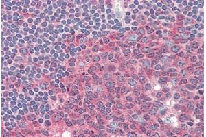 Human Tonsil (formalin-fixed, paraffin-embedded) stained with PKM2 antibody ABIN337171 at 1:100 followed by biotinylated goat anti-rabbit IgG secondary antibody ABIN481713, alkaline phosphatase-streptavidin and chromogen. (Pyruvate Kinase, Muscle (PKM) 抗体)