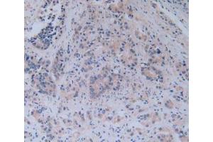 IHC-P analysis of Human Prostate Gland Tissue, with DAB staining. (TICAM1 抗体  (AA 443-685))