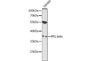 Western blot analysis of extracts of SW480 cells, using PP1 beta antibody  at 1:1000 dilution. (PPP1CB 抗体  (AA 1-327))